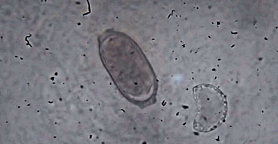 Egg of a capillaria worm