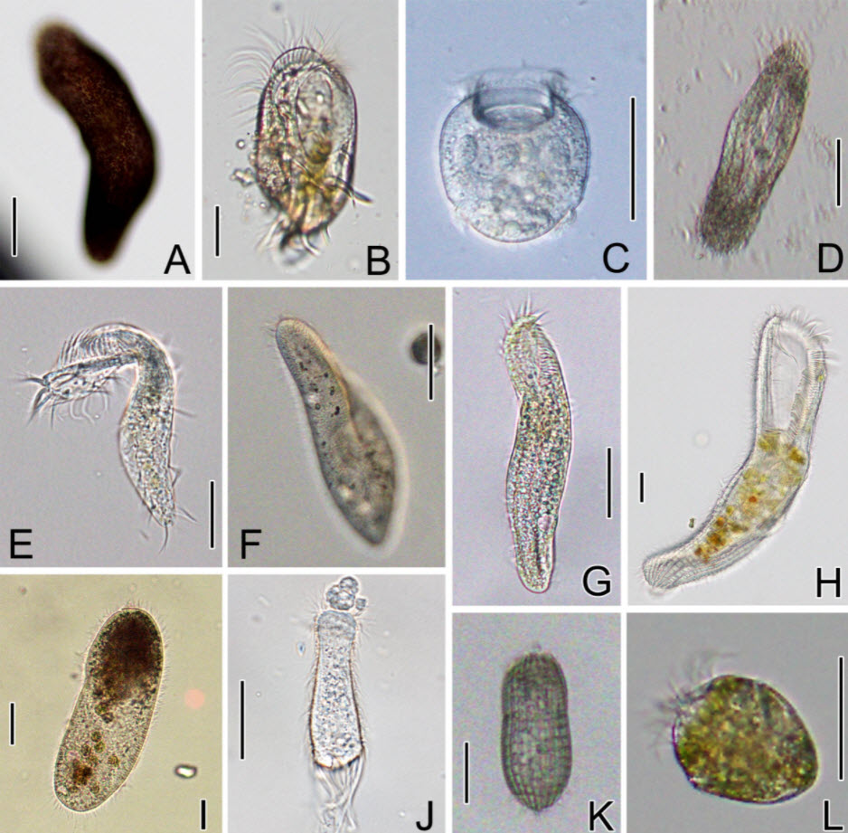 Typical Organisms in a Mature Aquarium